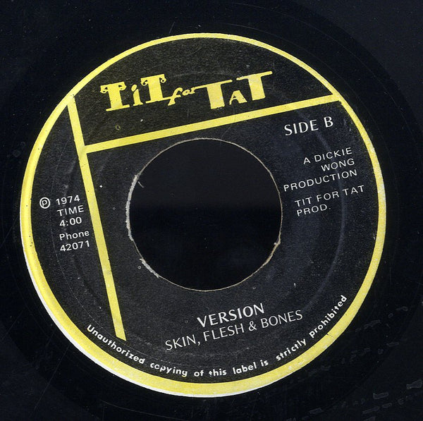 SKIN FLESH & BONES [Solitary Man]