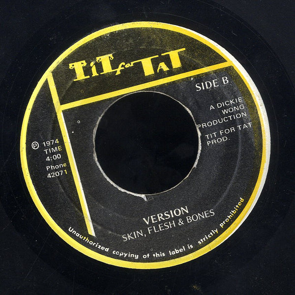 BEVERLY & RANCHIE [Solitary Man]